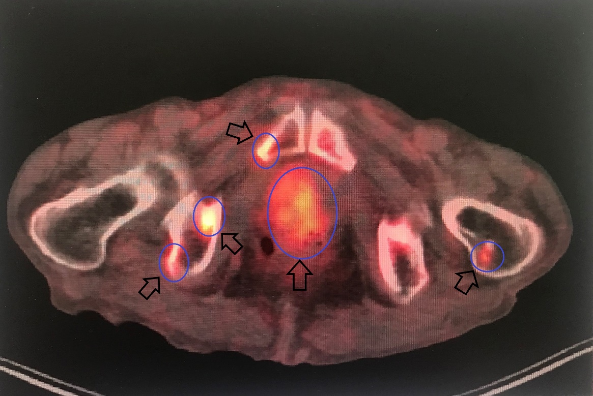 C:\Users\yilma\Downloads\pelvis prostat kemik beraber (1).jpg