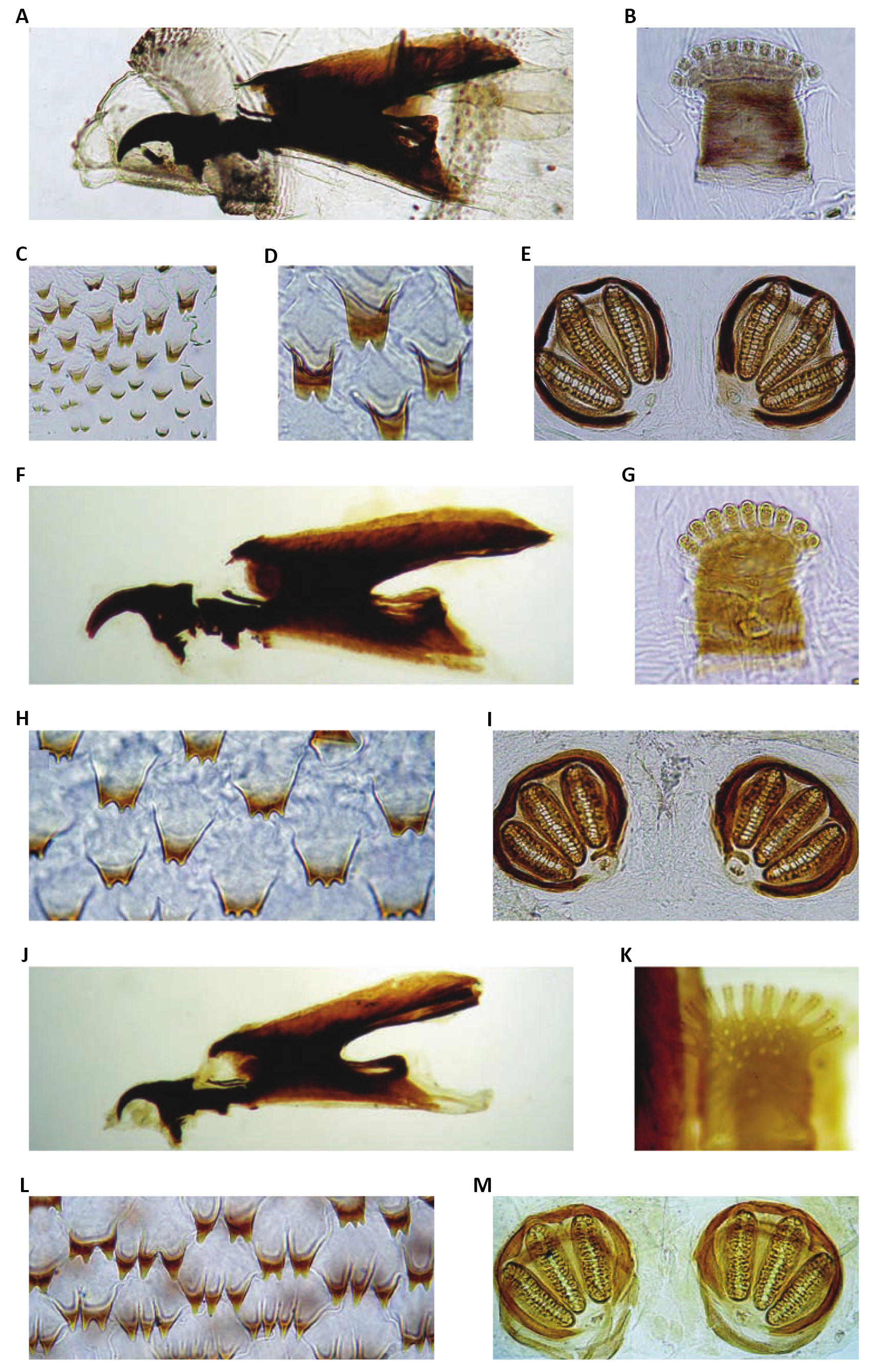 Asagittal section sheep head shows various larval stages bot fly in the