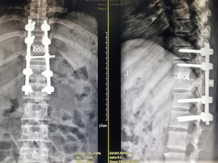 Figure 6